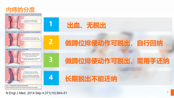 王業(yè)皇：痔瘡、便血怎么辦，正規(guī)醫(yī)院治療其實很簡單