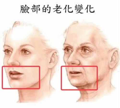 米揚麗格馬平山醫(yī)生采用PLLA艾維嵐在口周年輕化方面的成果(圖7)