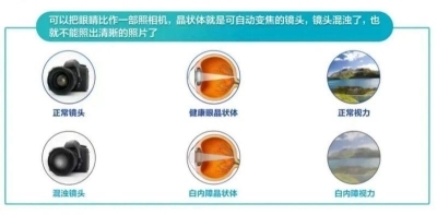 愛爾眼科：白內(nèi)障不會(huì)“缺席”只會(huì)“遲到”？(圖1)